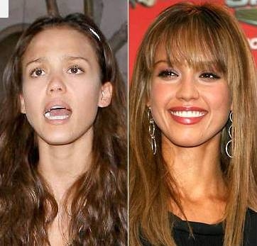 celebrities-before-after--large-msg-136752129301