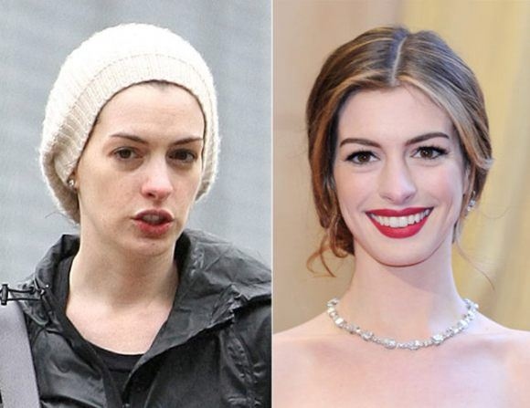 celebrities-before-after--large-msg-136752139244