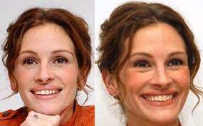 Julia Roberts sorriso